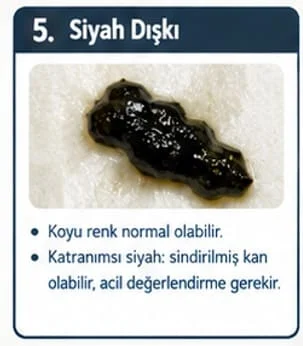 ⚫ Muhabbet kuşunun dışkısı neden siyah olur?
